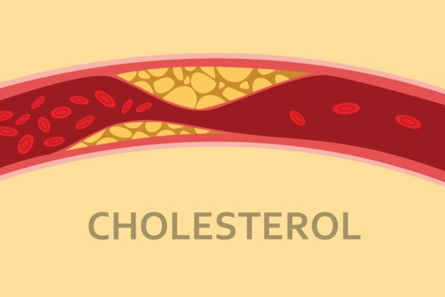 Elevated Cholesterol Levels