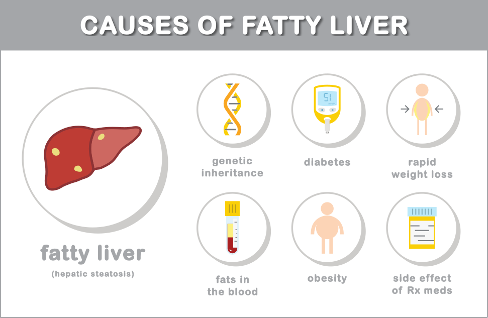 what causes a fatty liver