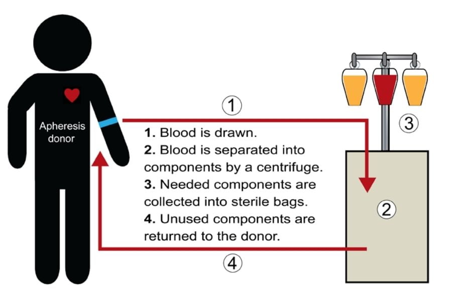 What Is Apheresis?