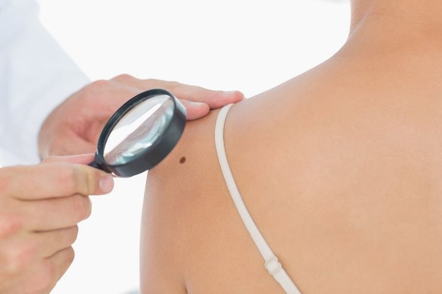 Skin Cancer Screening