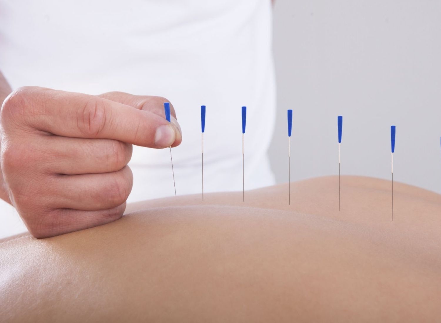 Acupuncture: The Chinese Magical Healing Invention