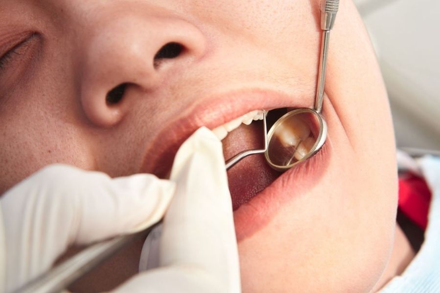 How Does Your Dentist Diagnose Tooth Decay?