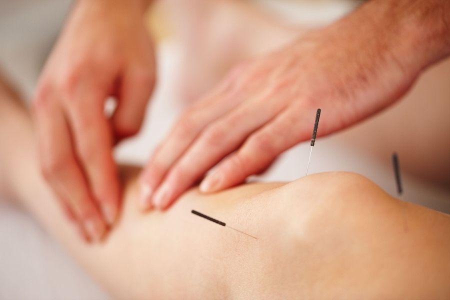 Health Benefits Of Acupuncture