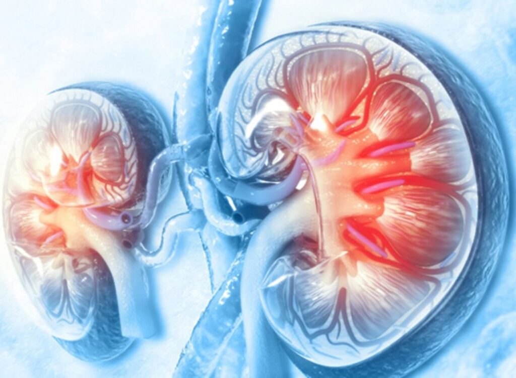 5 Stages Of Chronic Kidney Disease