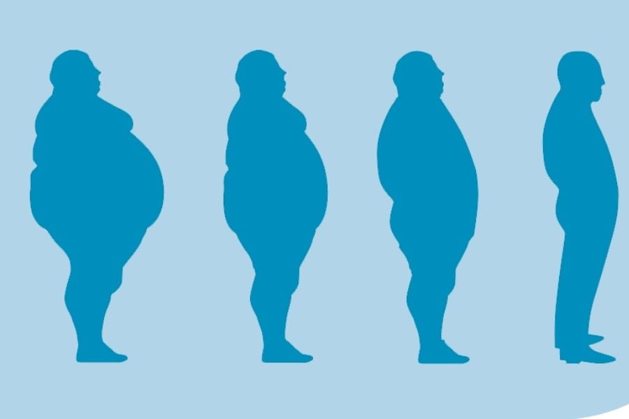 Obesity and Type 2 Diabetes