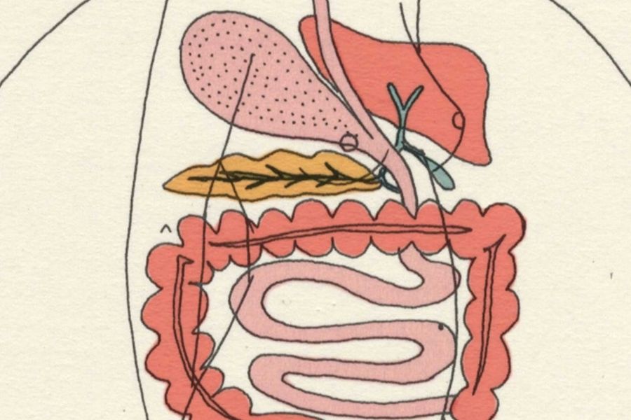 Irritable Bowel Syndrome (IBS)