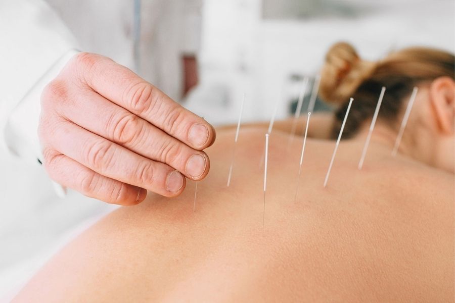 How Does Acupuncture Work?