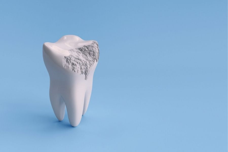 tooth erosion